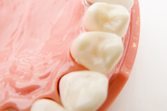 前歯の差し歯や銀歯を自然な白い歯にしたい